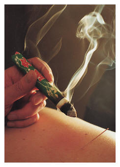 【小知识】中医艾灸为何要用“陈艾”