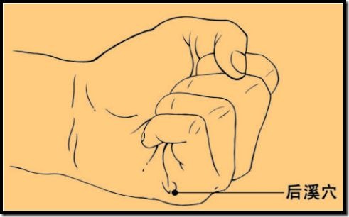 【后溪穴】统治一切颈肩腰椎病